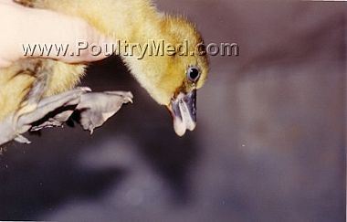 Organophosphate poisoning